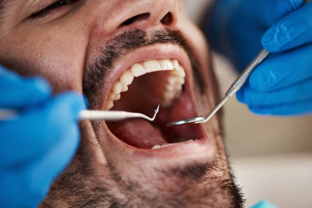 Best Emergency Tooth Extraction in Rushville, NE